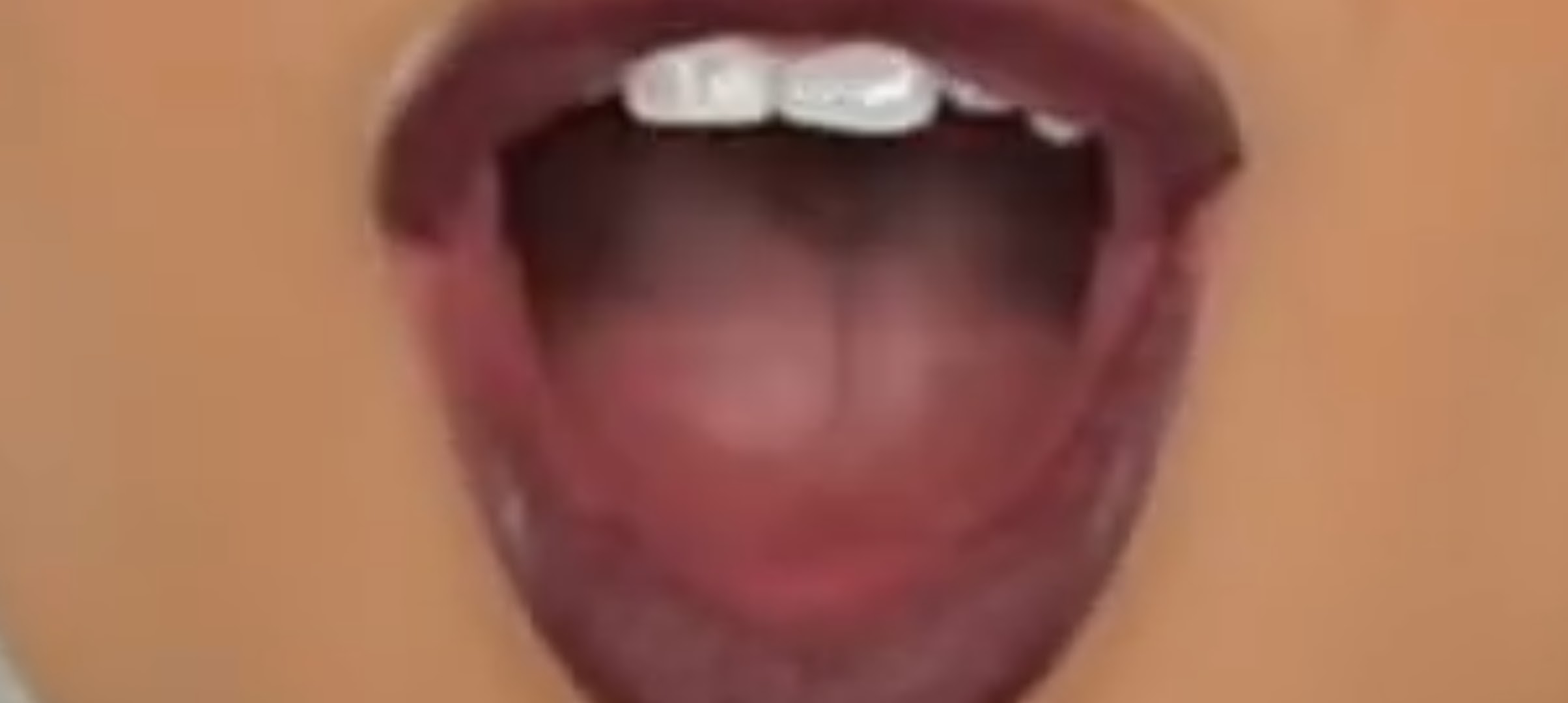 Photo from Amy Rose Walker Tongue Mouth 