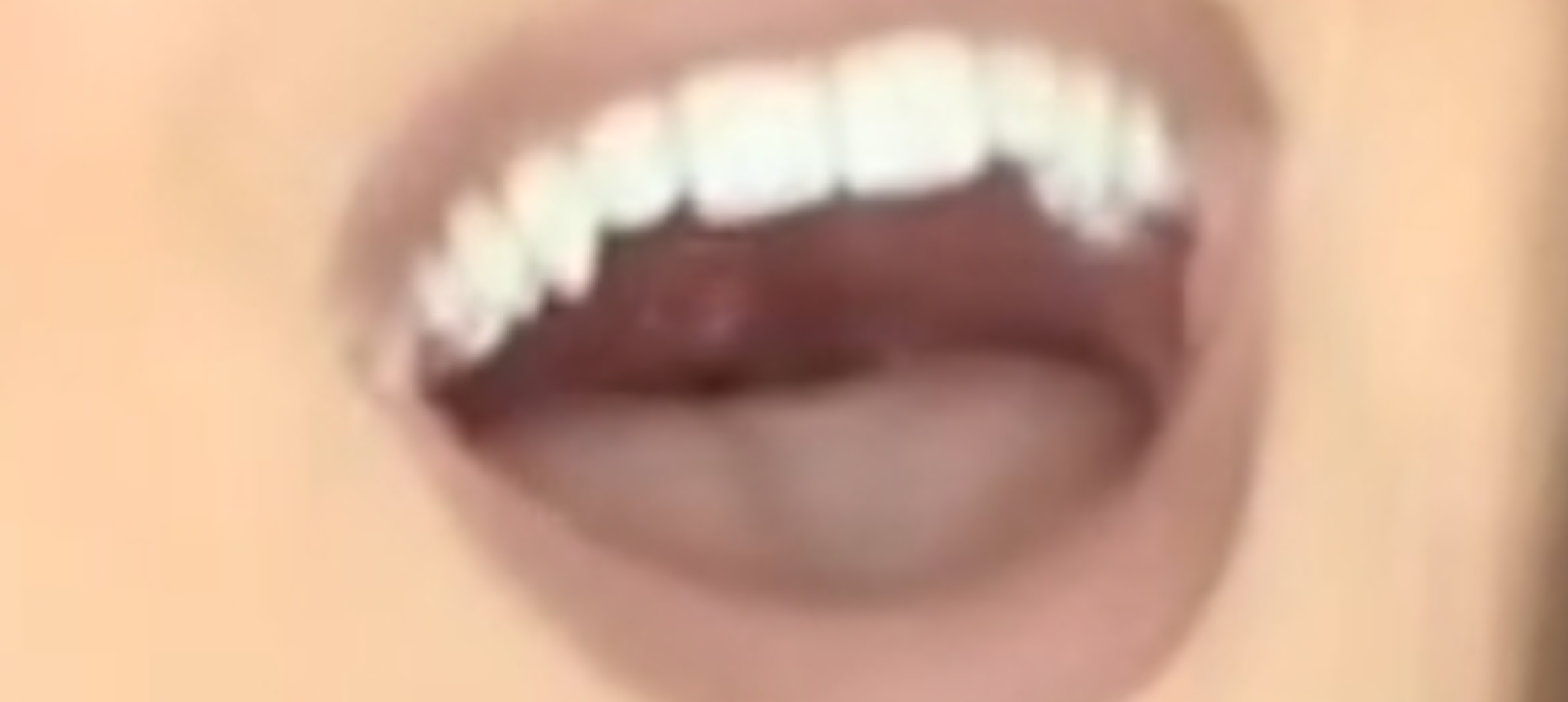 Photo from Amy Rose Walker Tongue Mouth 