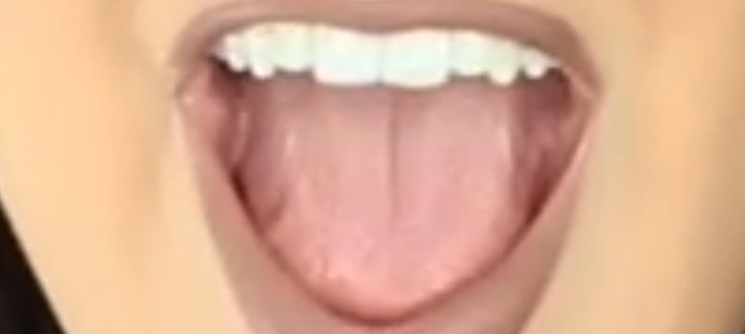Photo from Amy Rose Walker Tongue Mouth 