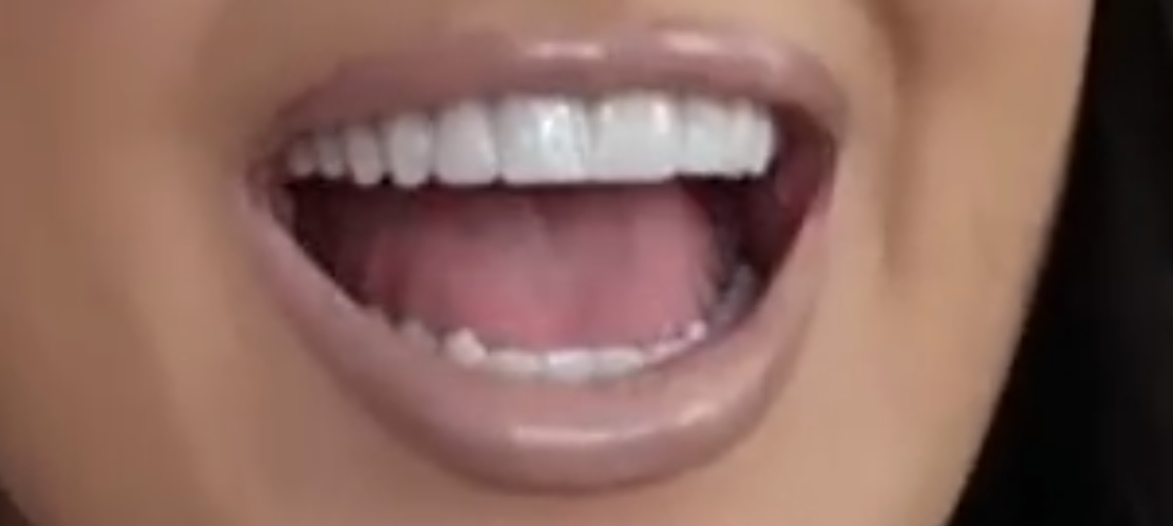 Photo from Amy Rose Walker Tongue Mouth 