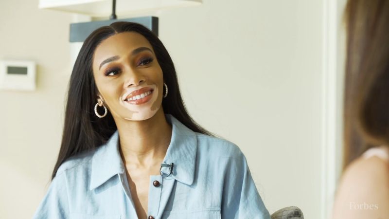 Winnie Harlow surprised with a hairstyle in the Bob Marley style 